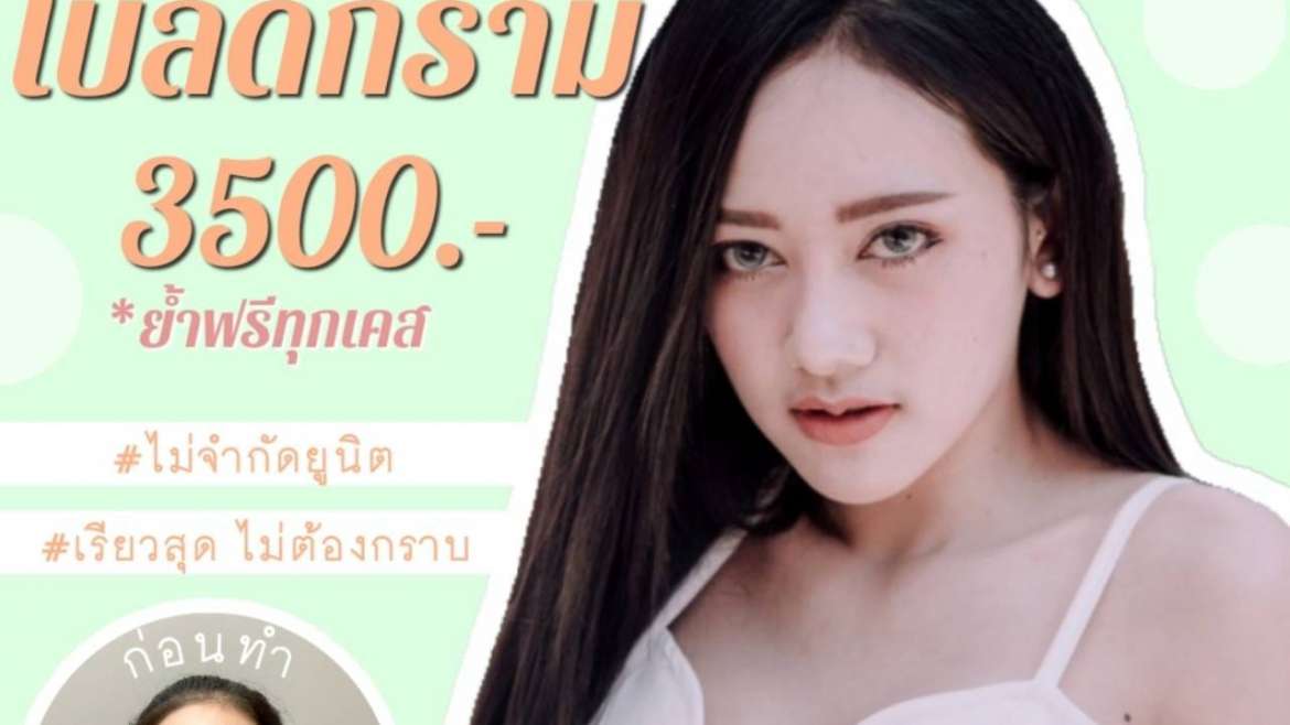 รีวิวโบท็อกซ์ 7