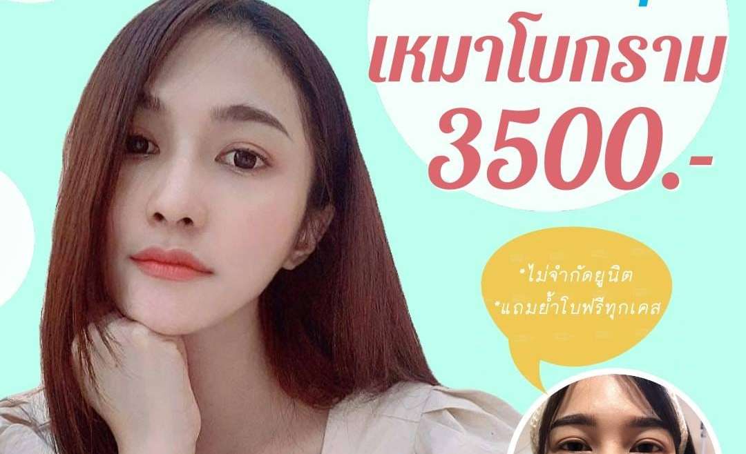 รีวิวโบท็อกซ์ 9
