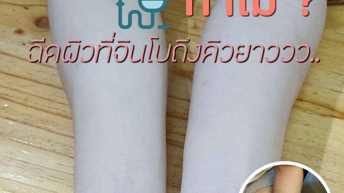 รีวิวฉีดผิว
