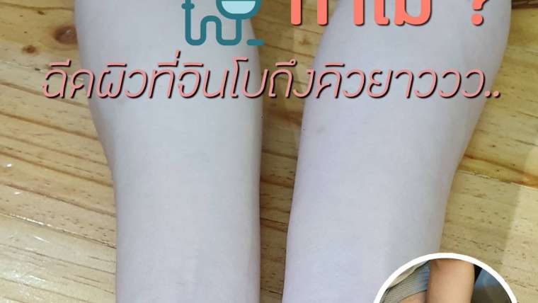 รีวิวฉีดผิว
