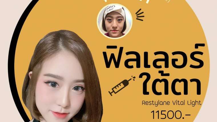 รีวิวฟิลเตอร์ใต้ตา
